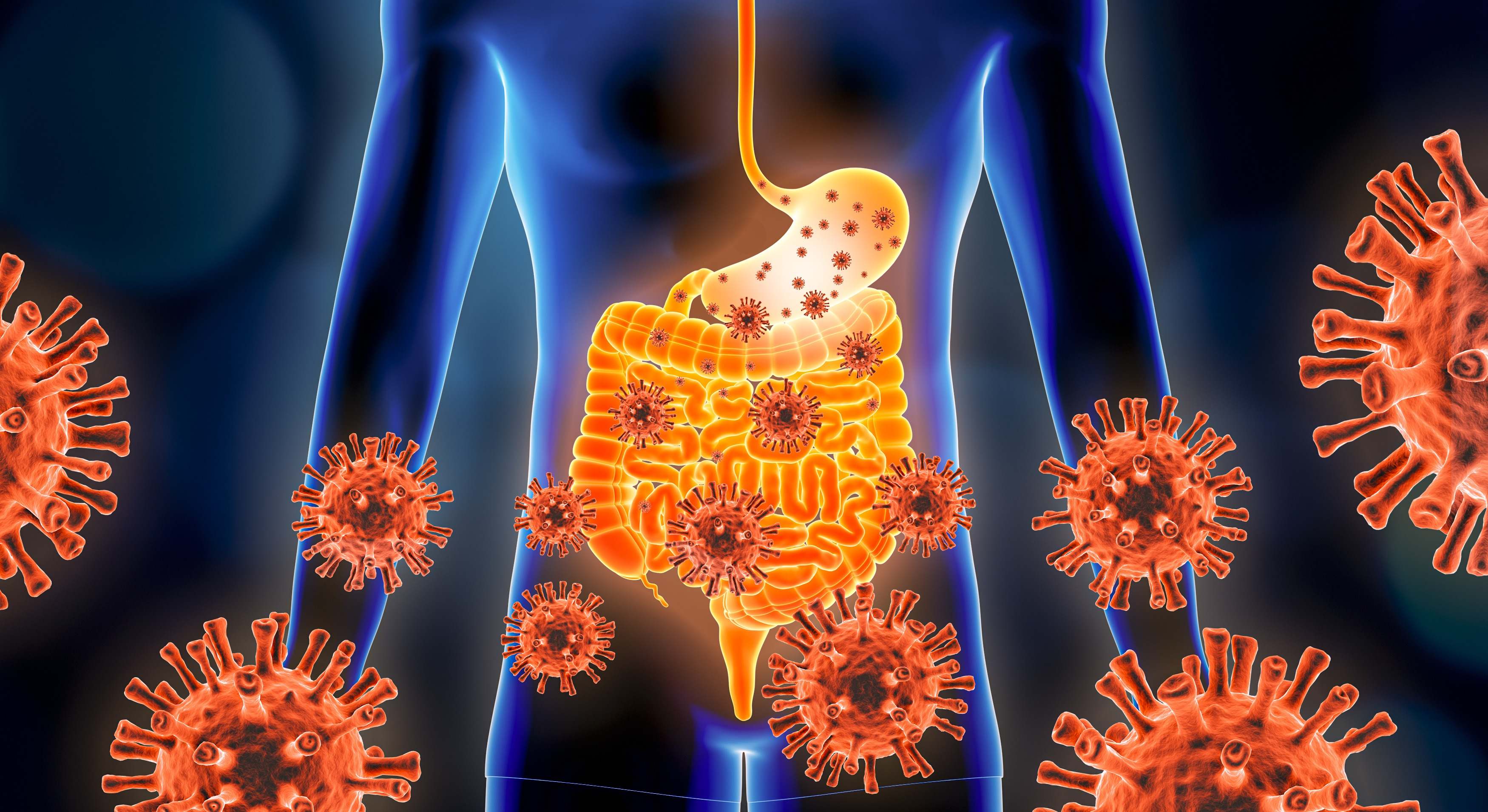 Ilustración 3D de una enfermedad viral, infecciosa e inflamatoria del tracto gástrico o gastrointestinal