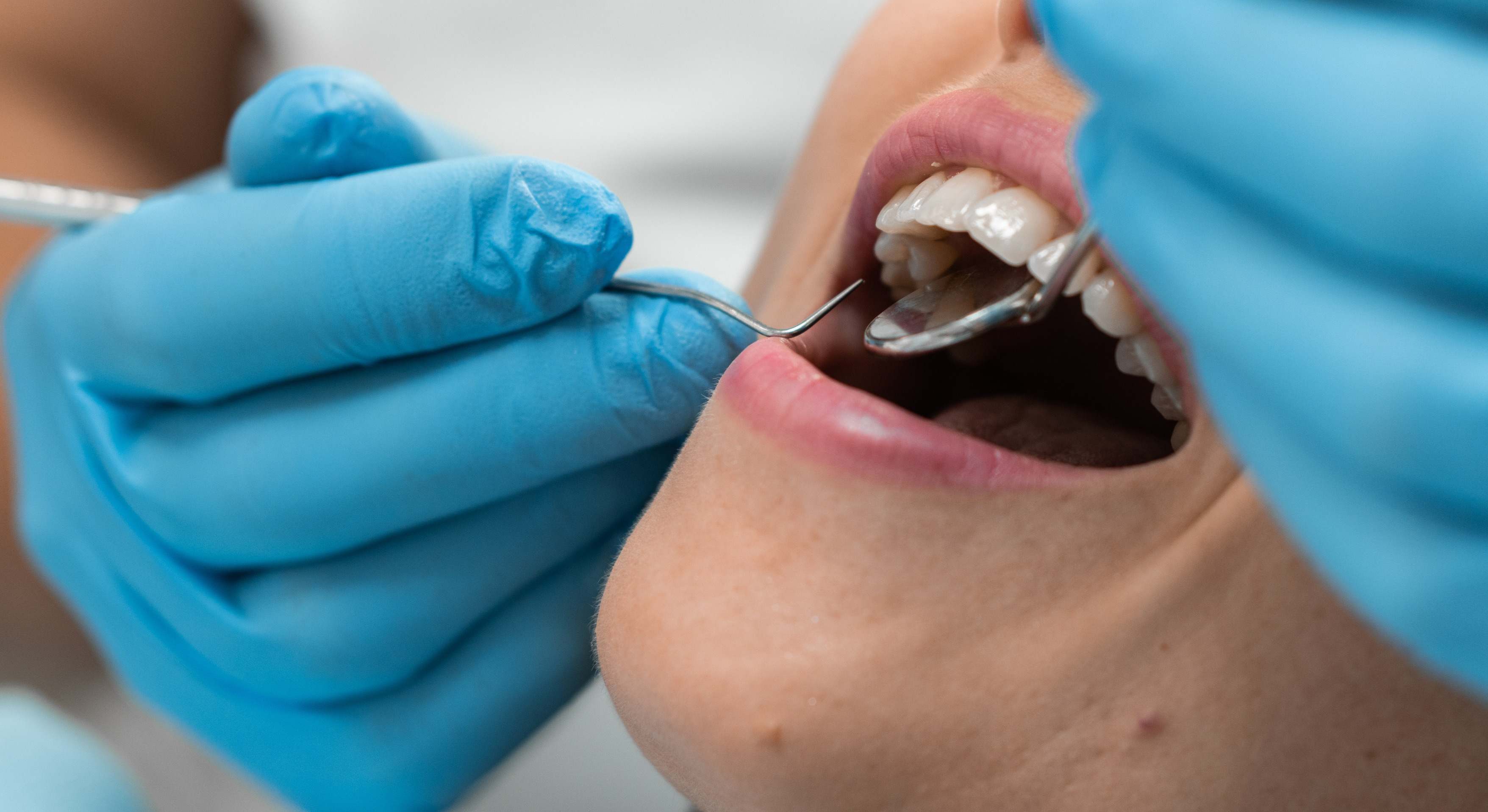 Un odontólogo revisa la boca de un paciente. / Foto: iStock