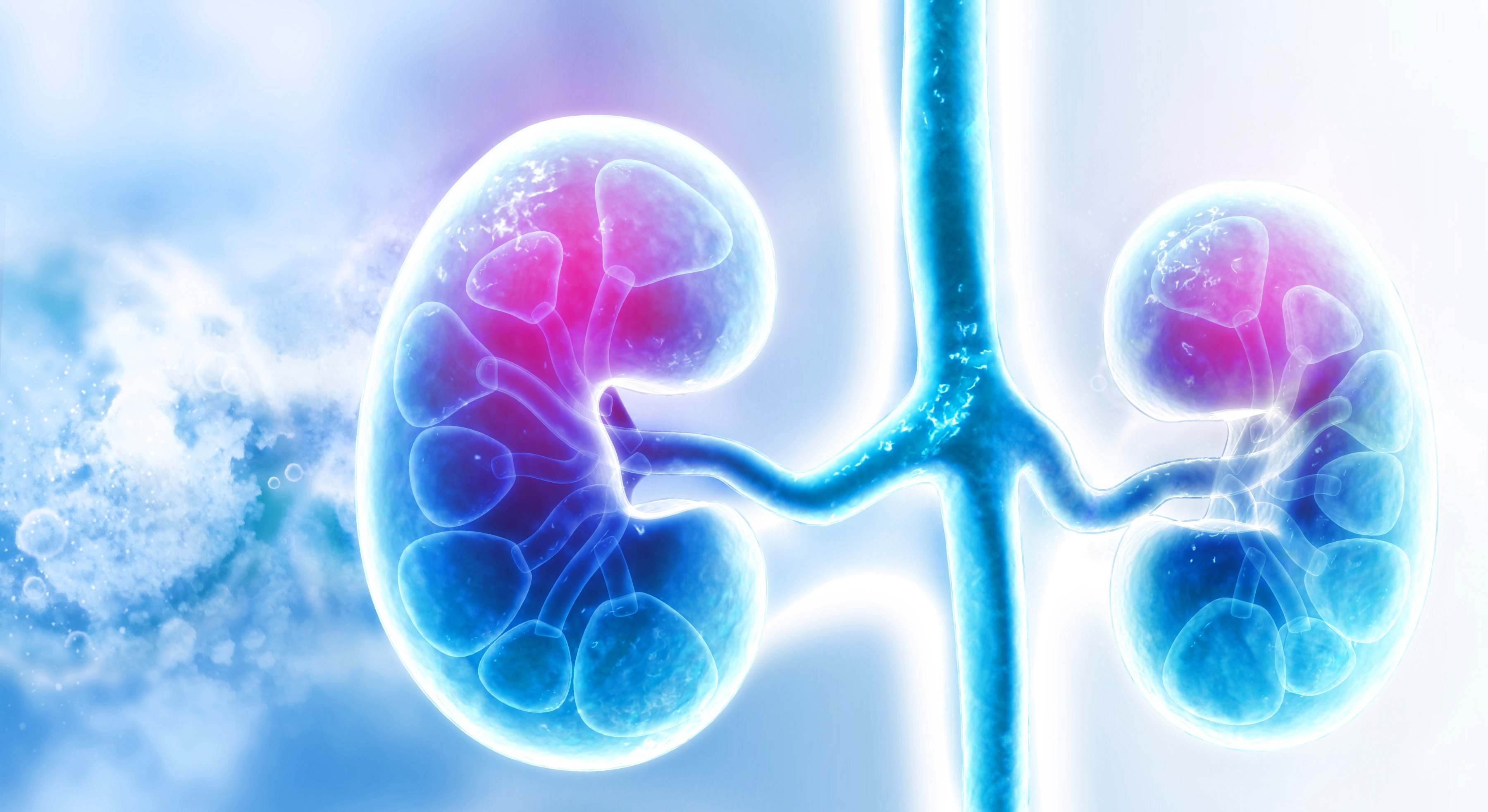 Cáncer de riñón