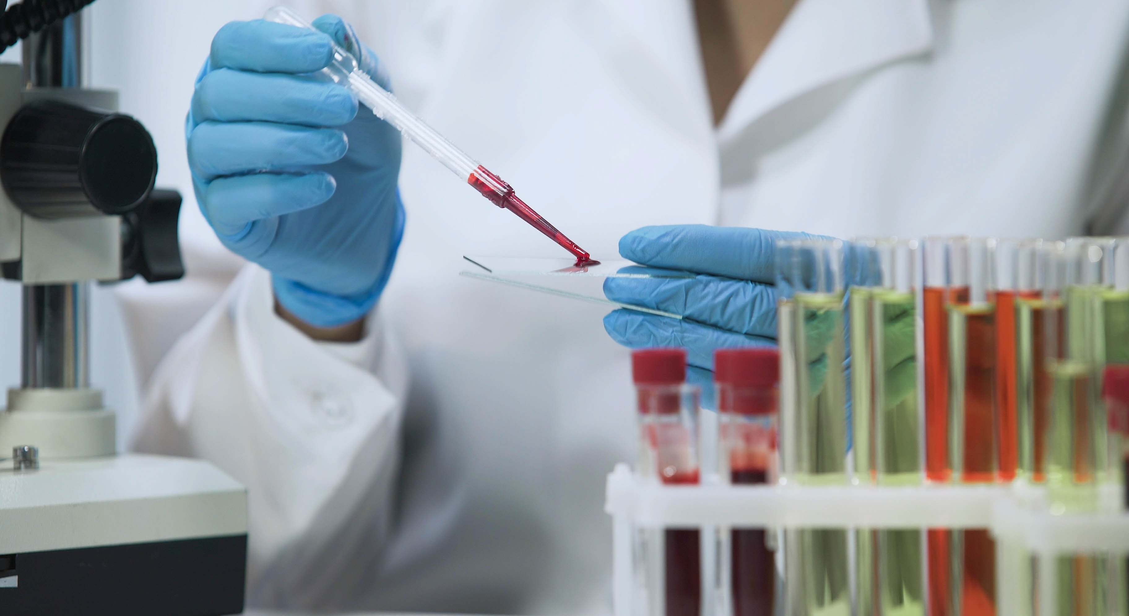 Muestras de sangre en un laboratorio
