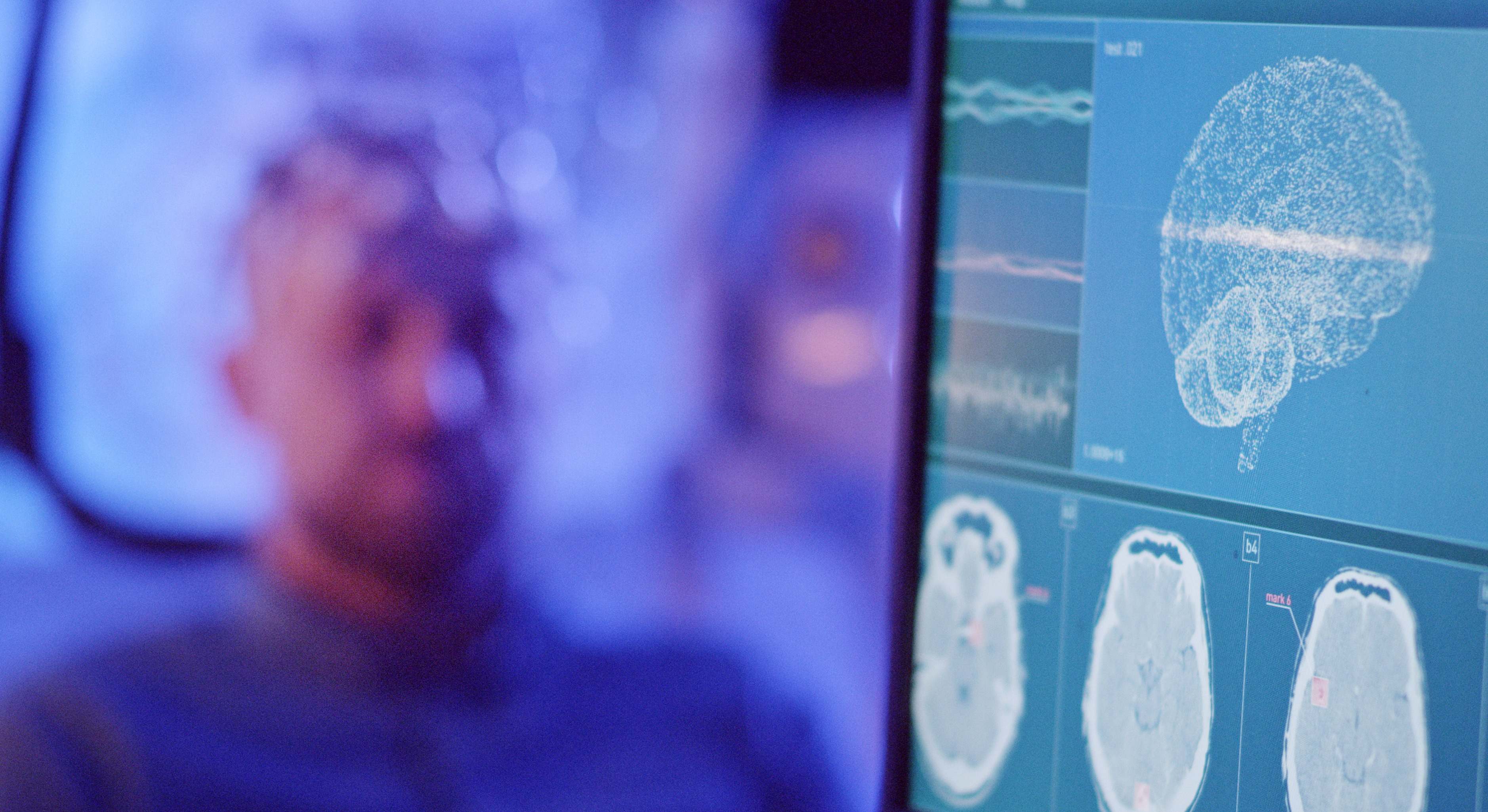 Examen cerebral en un hombre