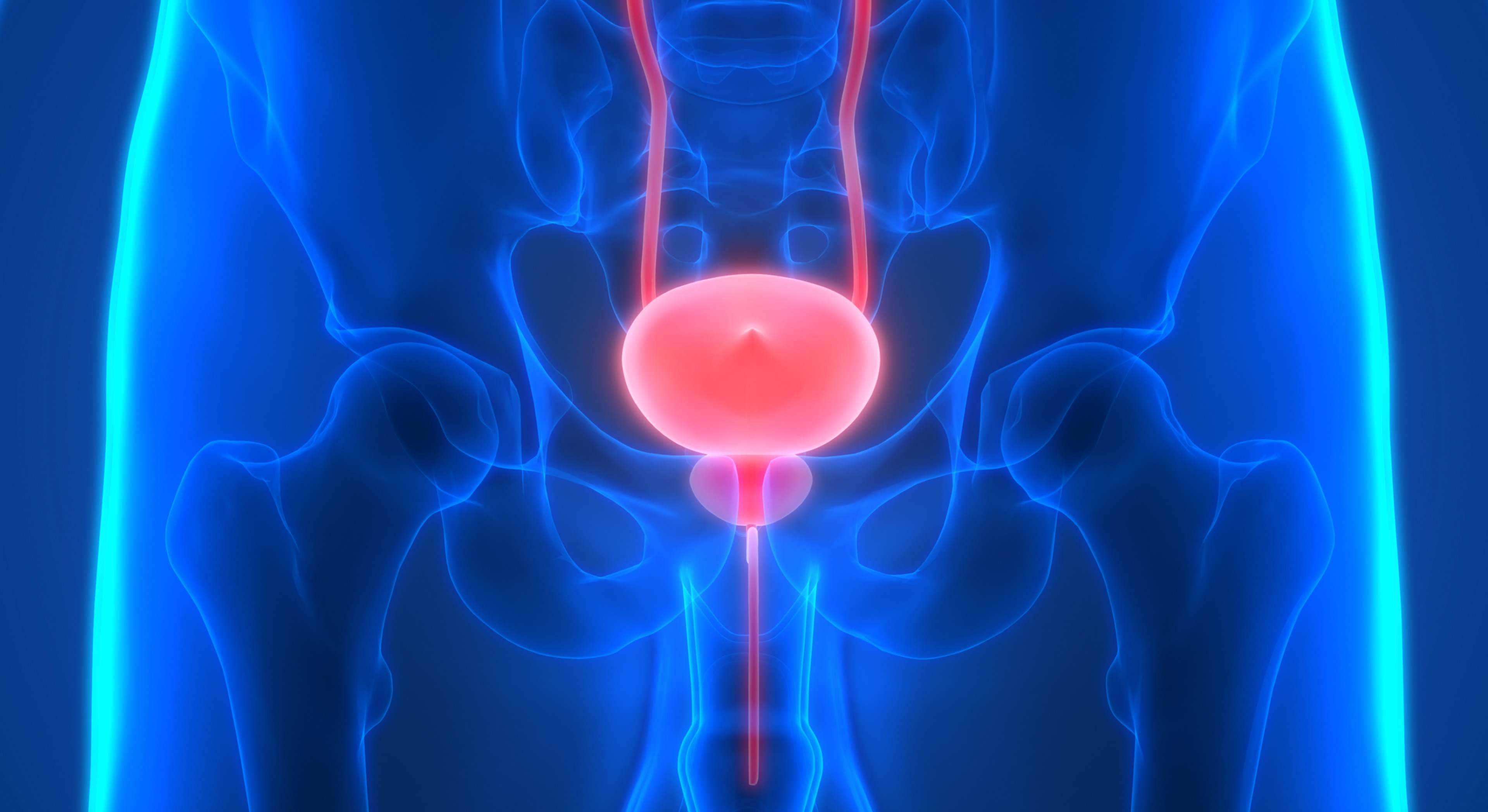 Cáncer de próstata