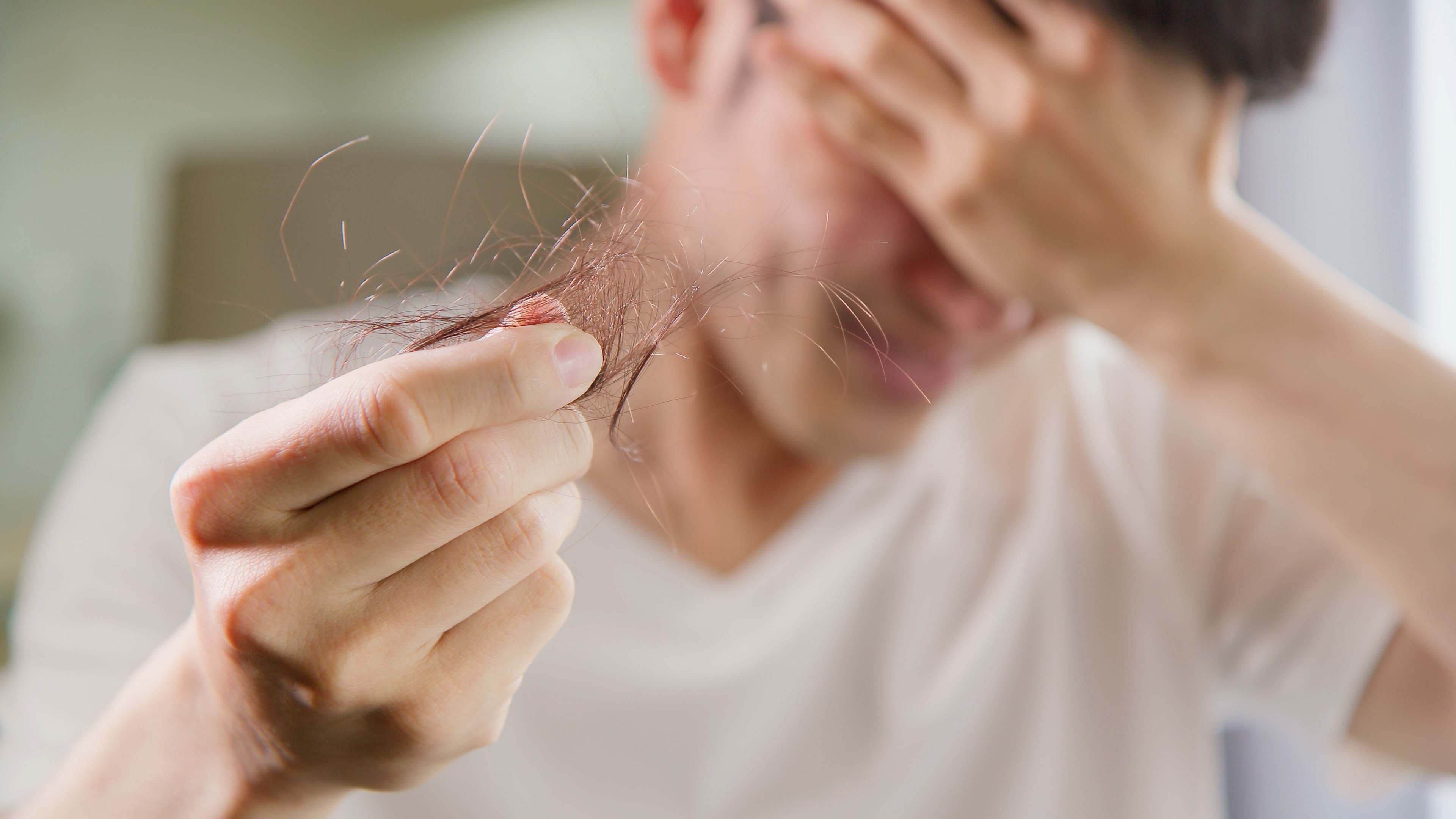 Caída de pelo 