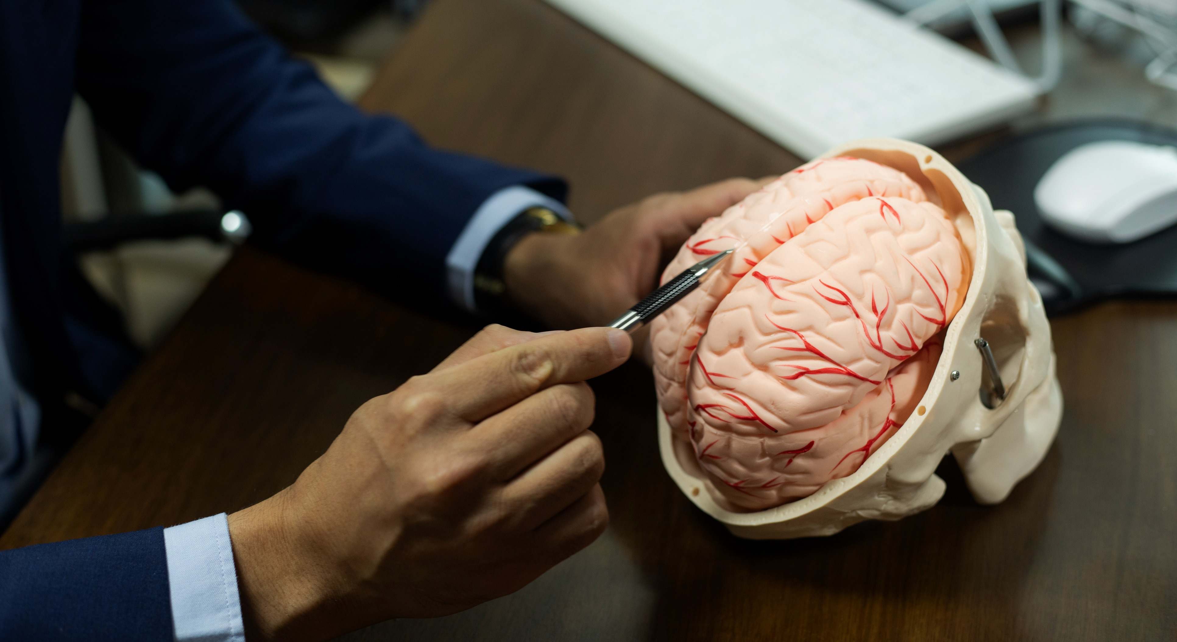 Cerebro
