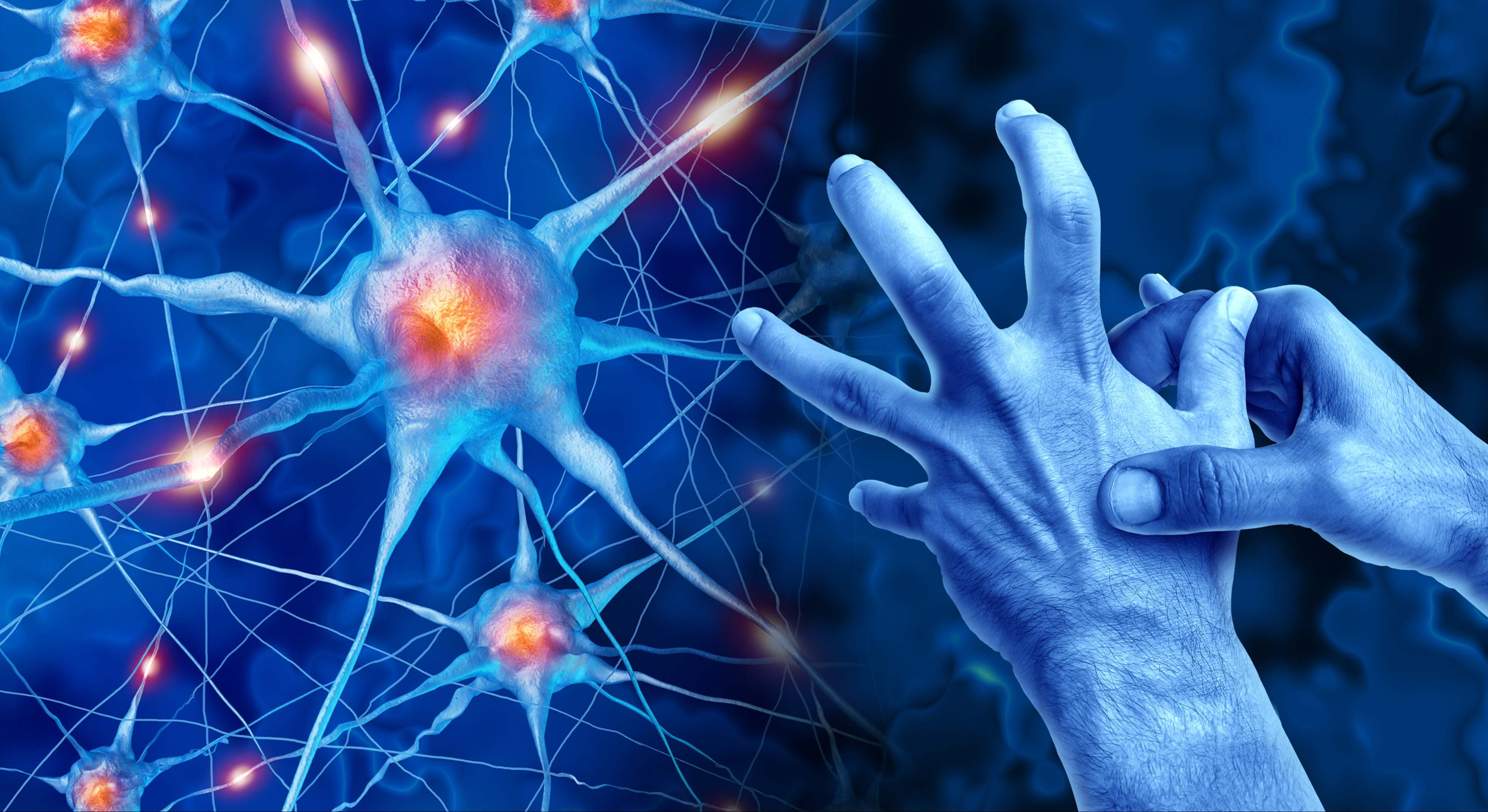 Ilustración de neuronas y mano para ejemplificar el párkinson