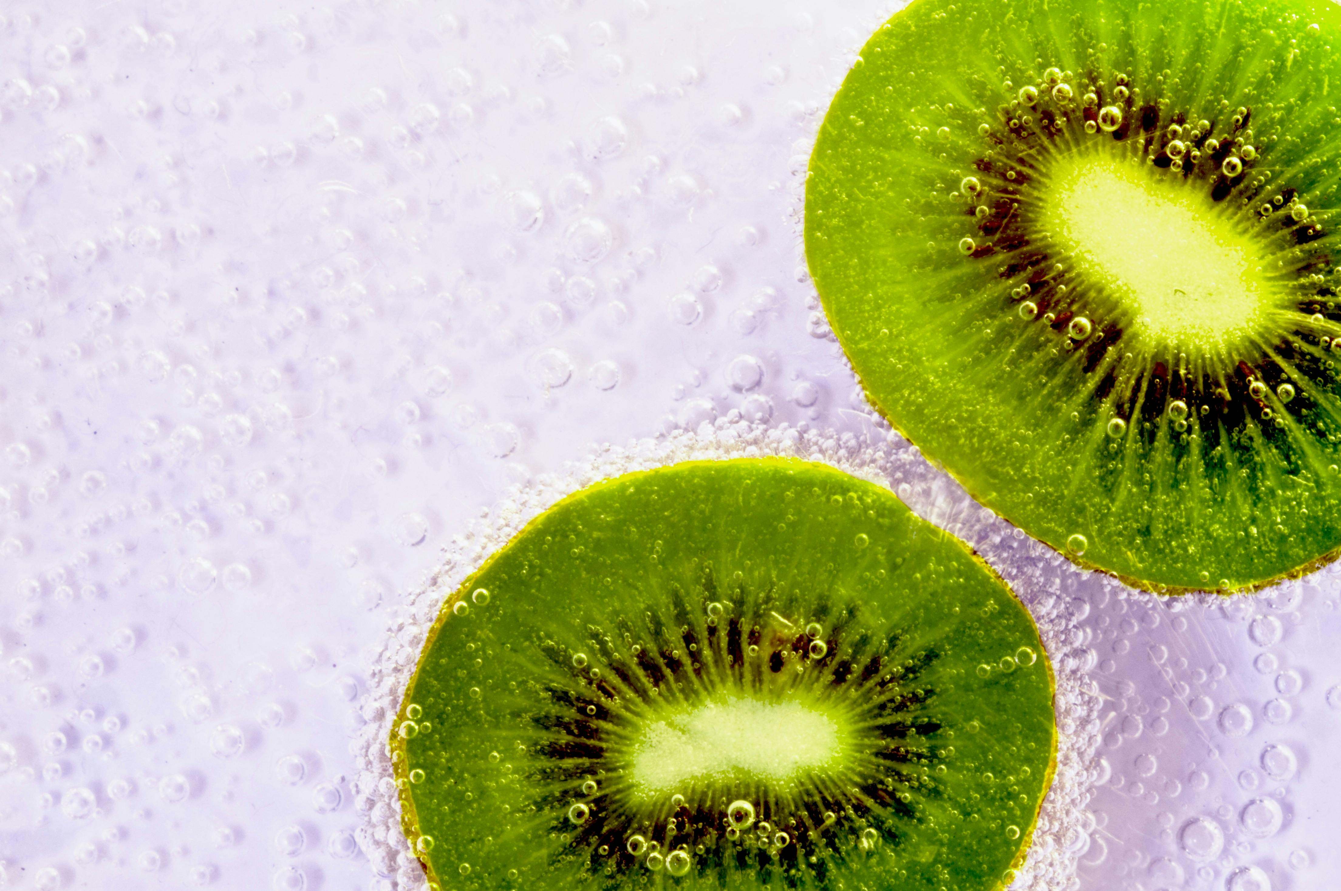 El kiwi produce múltiples beneficios en el cuerpo
