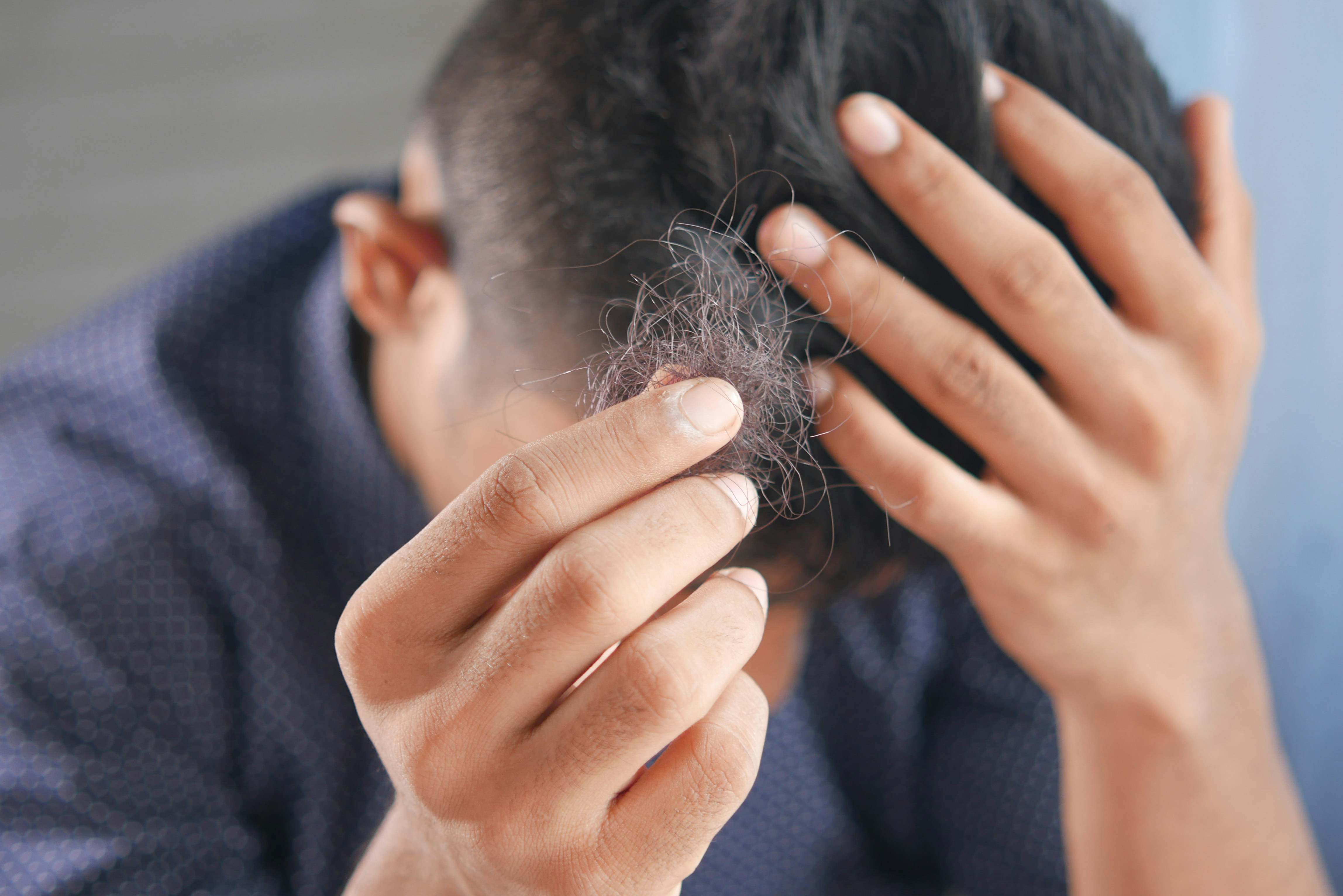 La caída del cabello en otoño es algo normal y forma parte del proceso natural de los ciclos de renovación del pelo