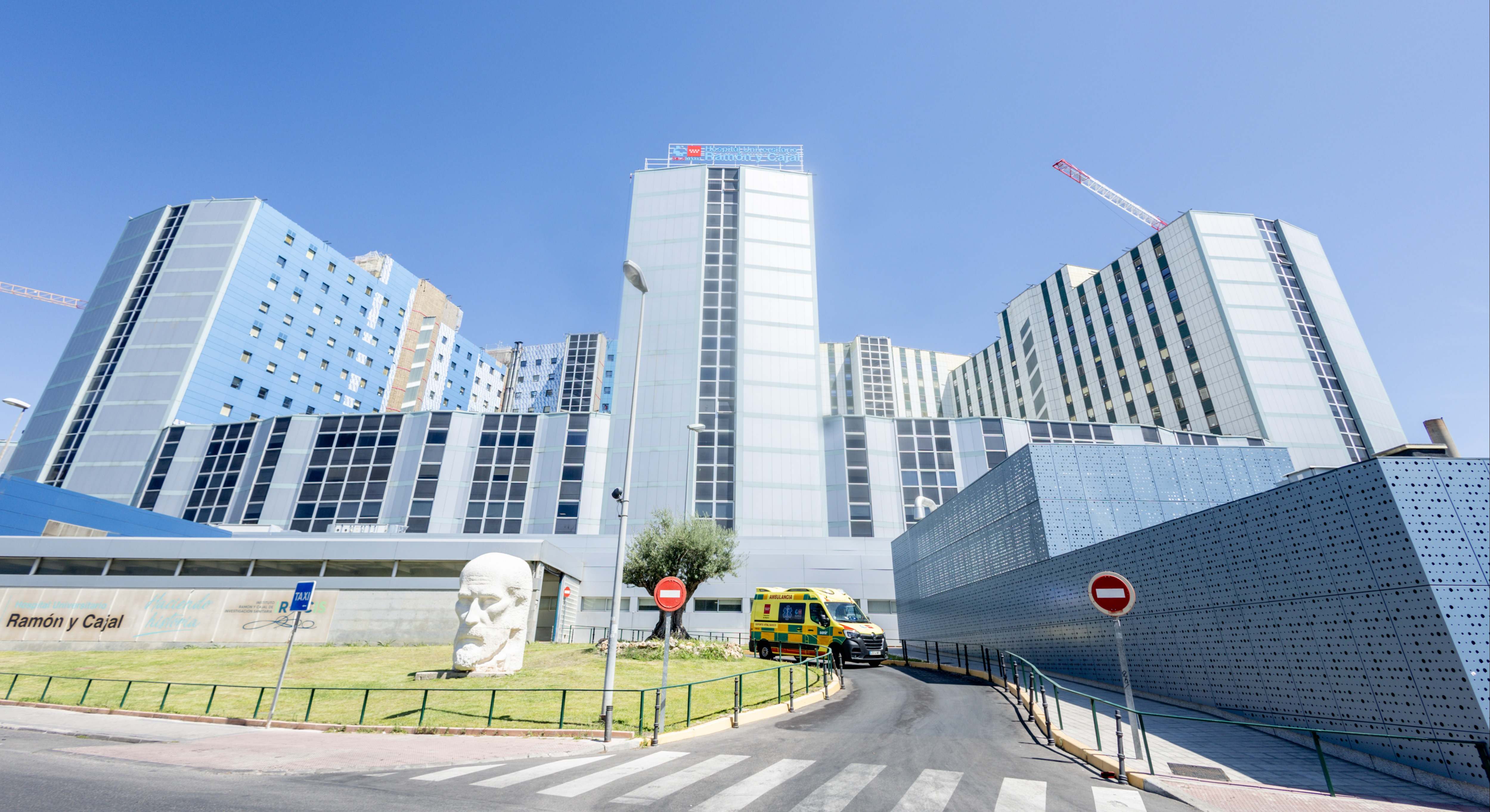 Postoperatorio del corazón sin cicatrices ni dolor "significativo": el Ramón y Cajal realiza con éxito el primer implante de la prótesis valvular mitral percutánea
