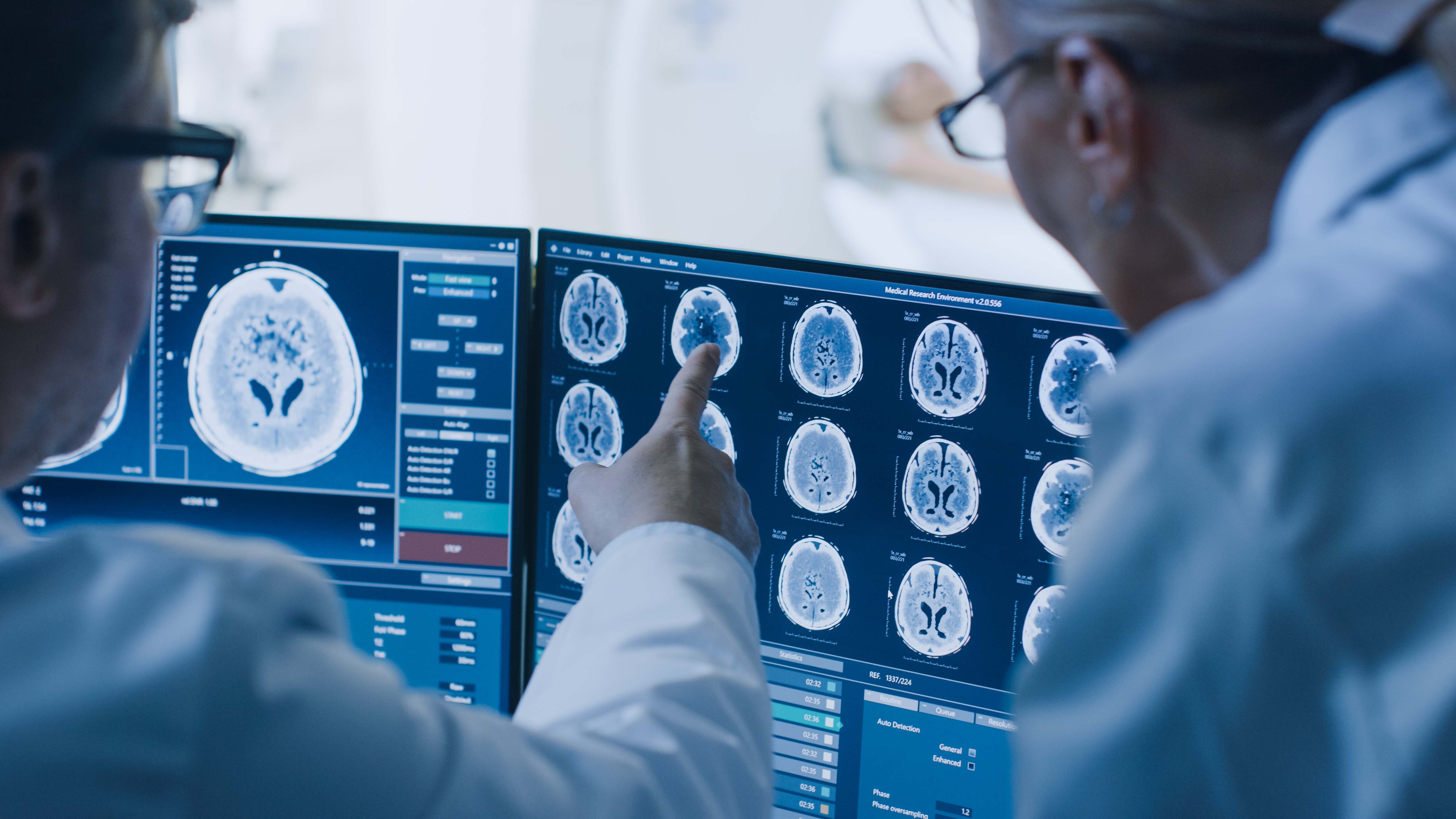 Estudio del cerebro.