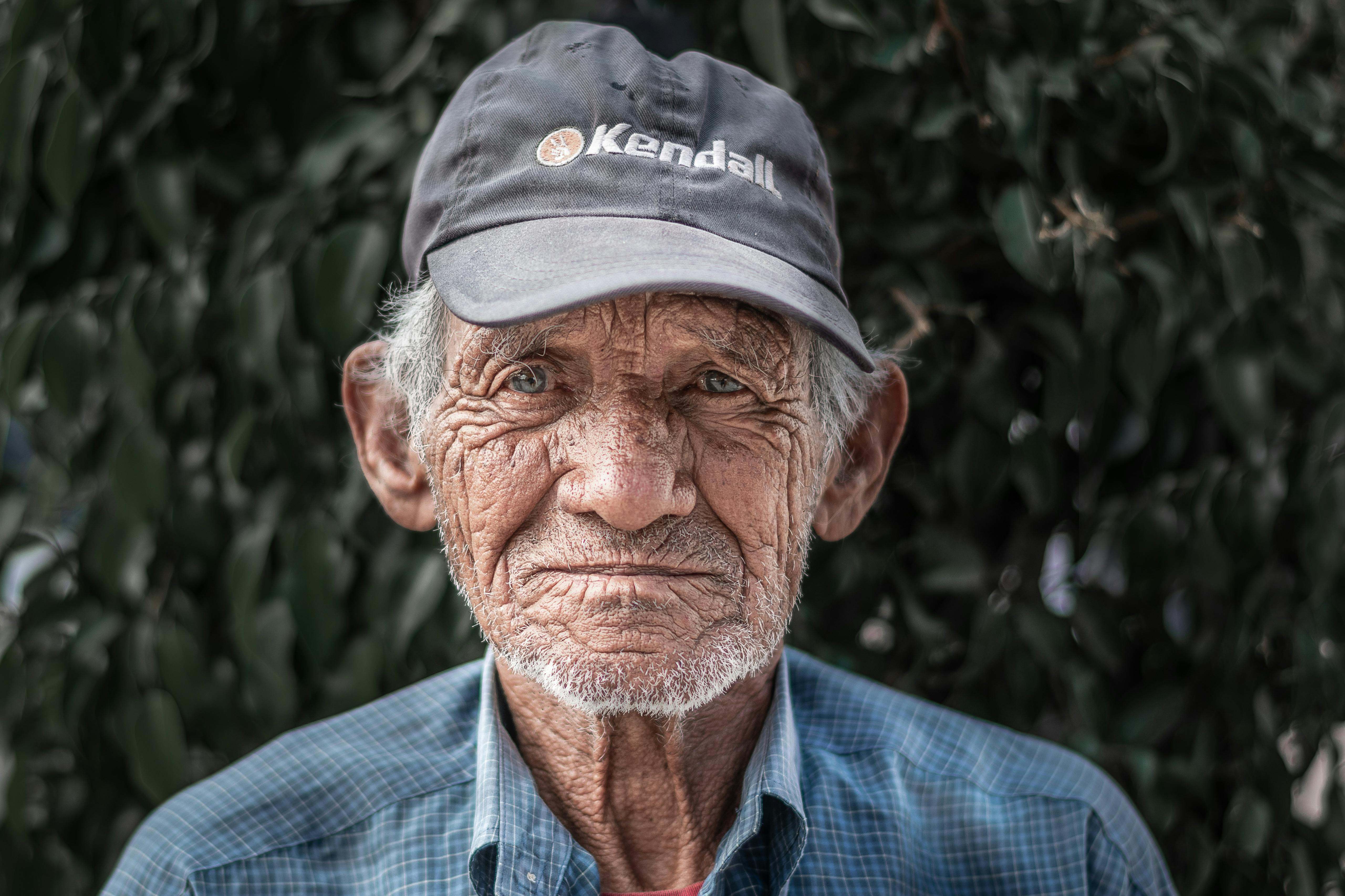 Las arrugas son una parte natural del envejecimiento