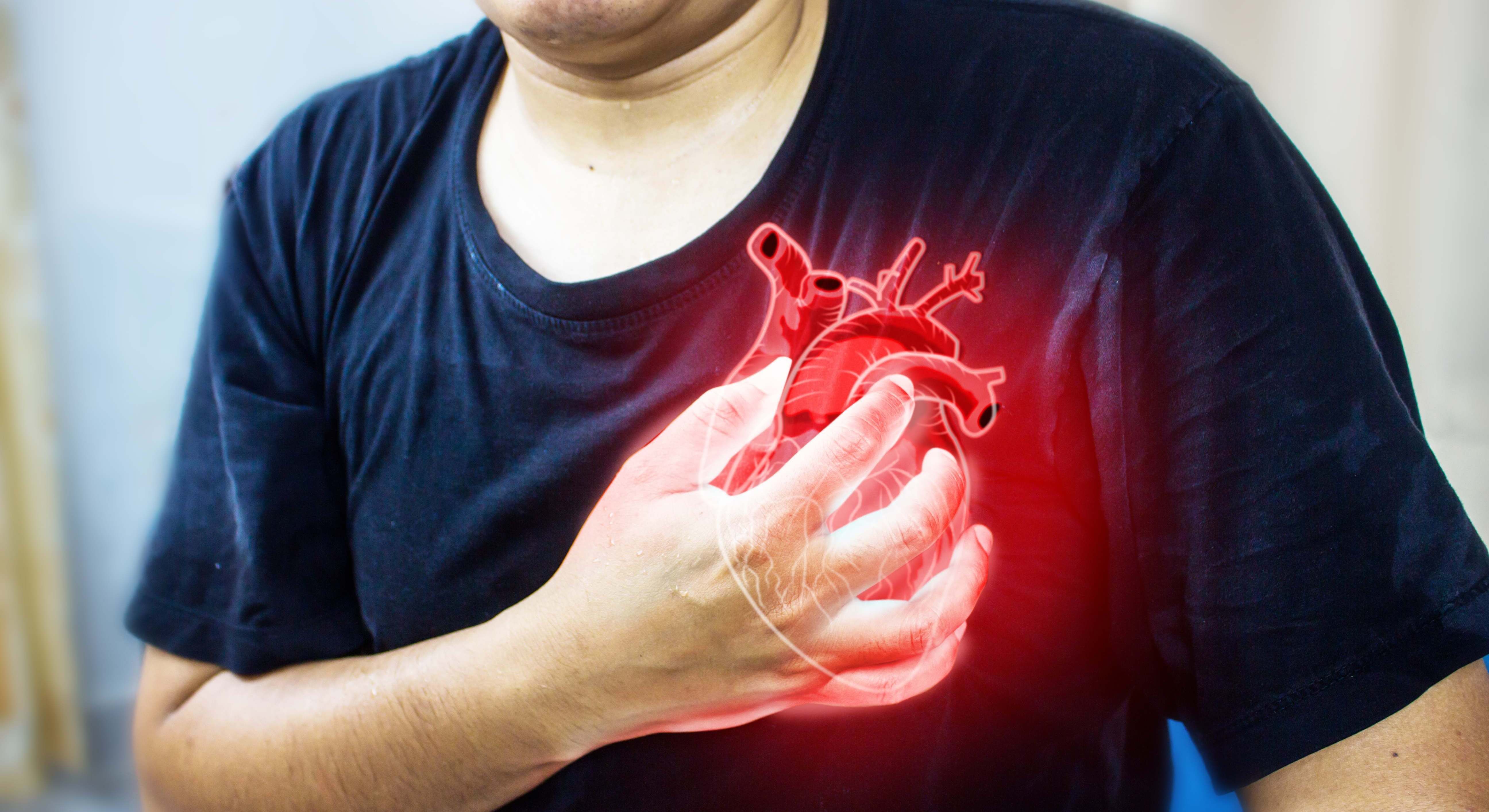 infarto