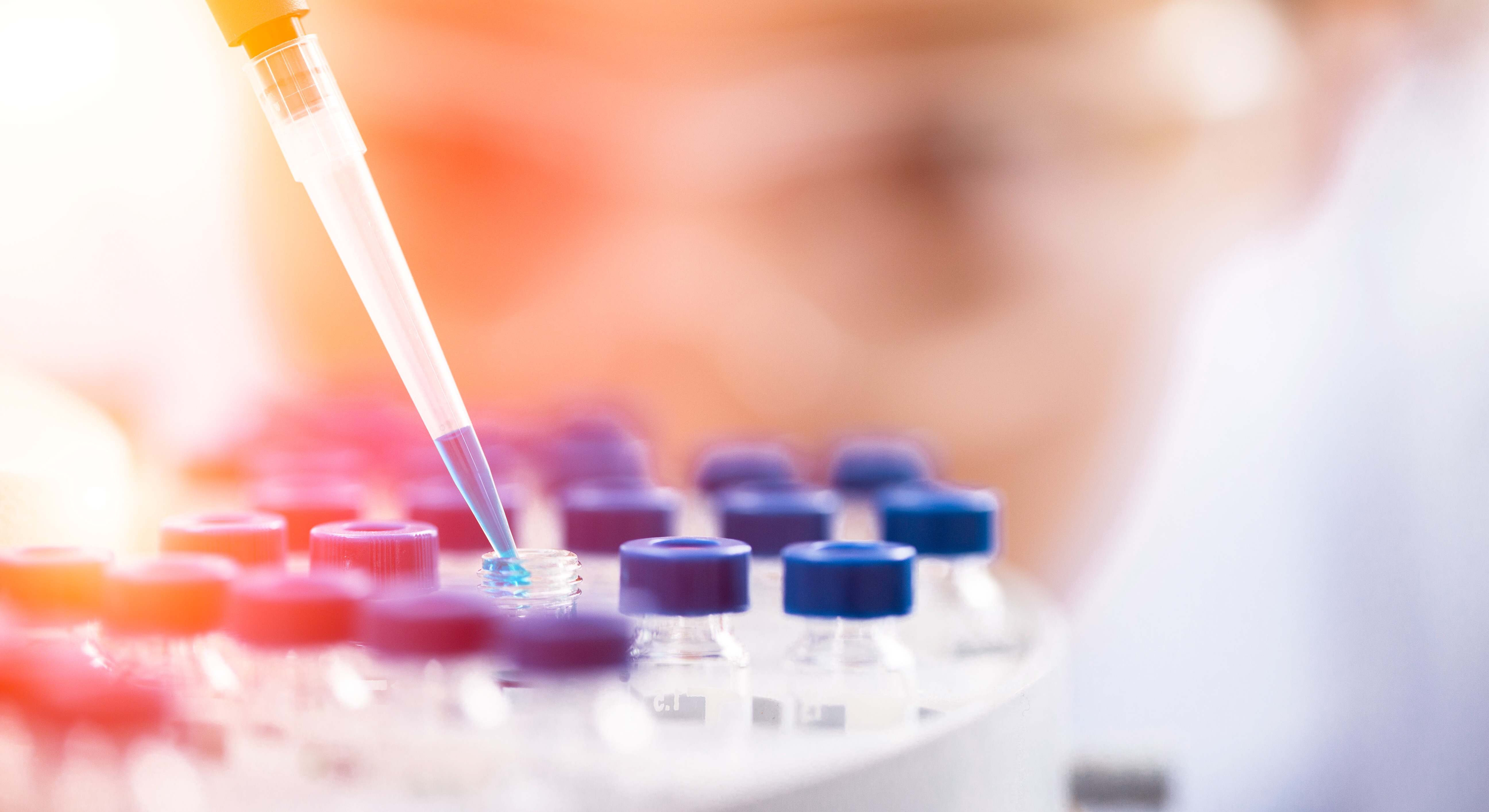 Imagen de recurso de una investigación