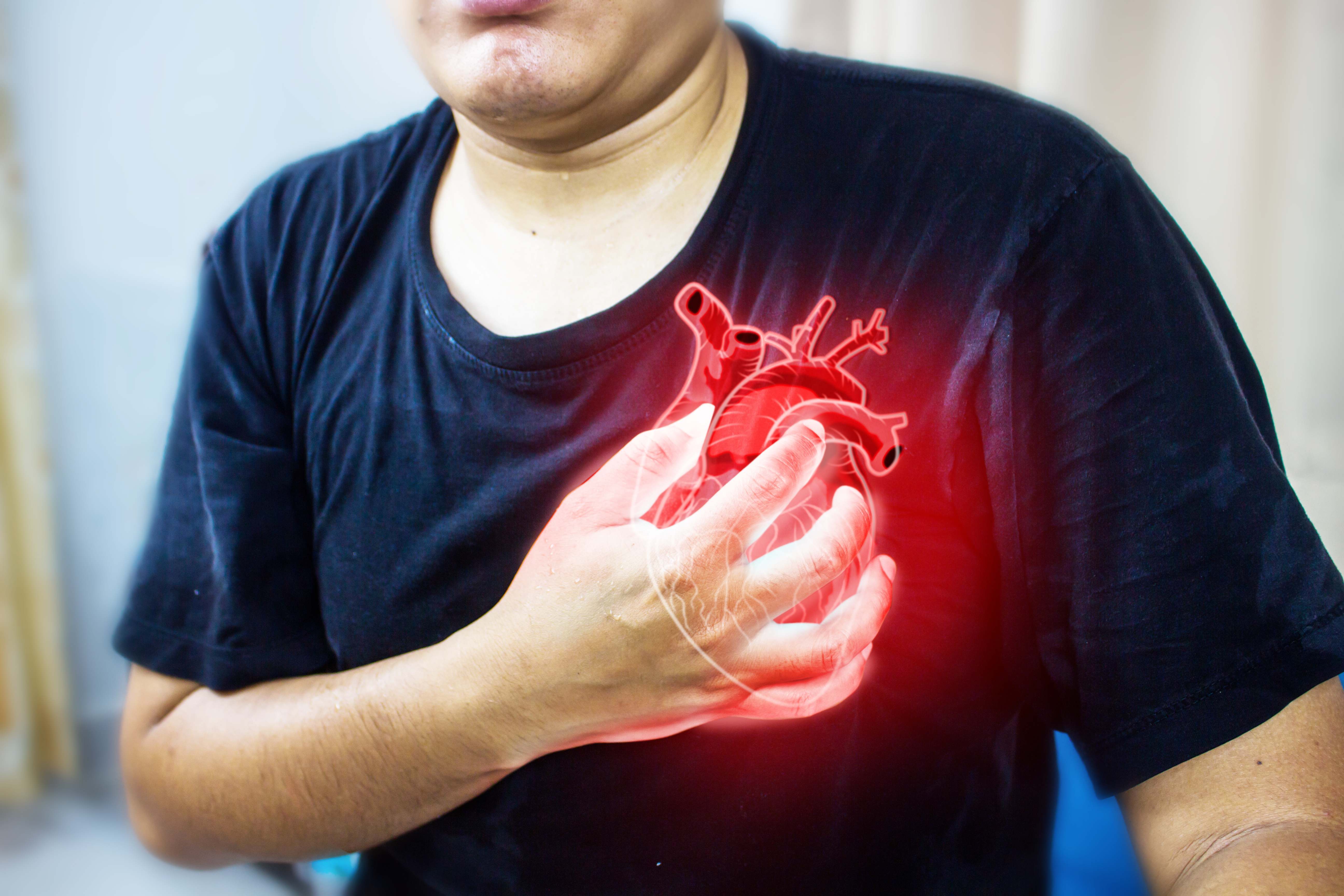 Infarto.