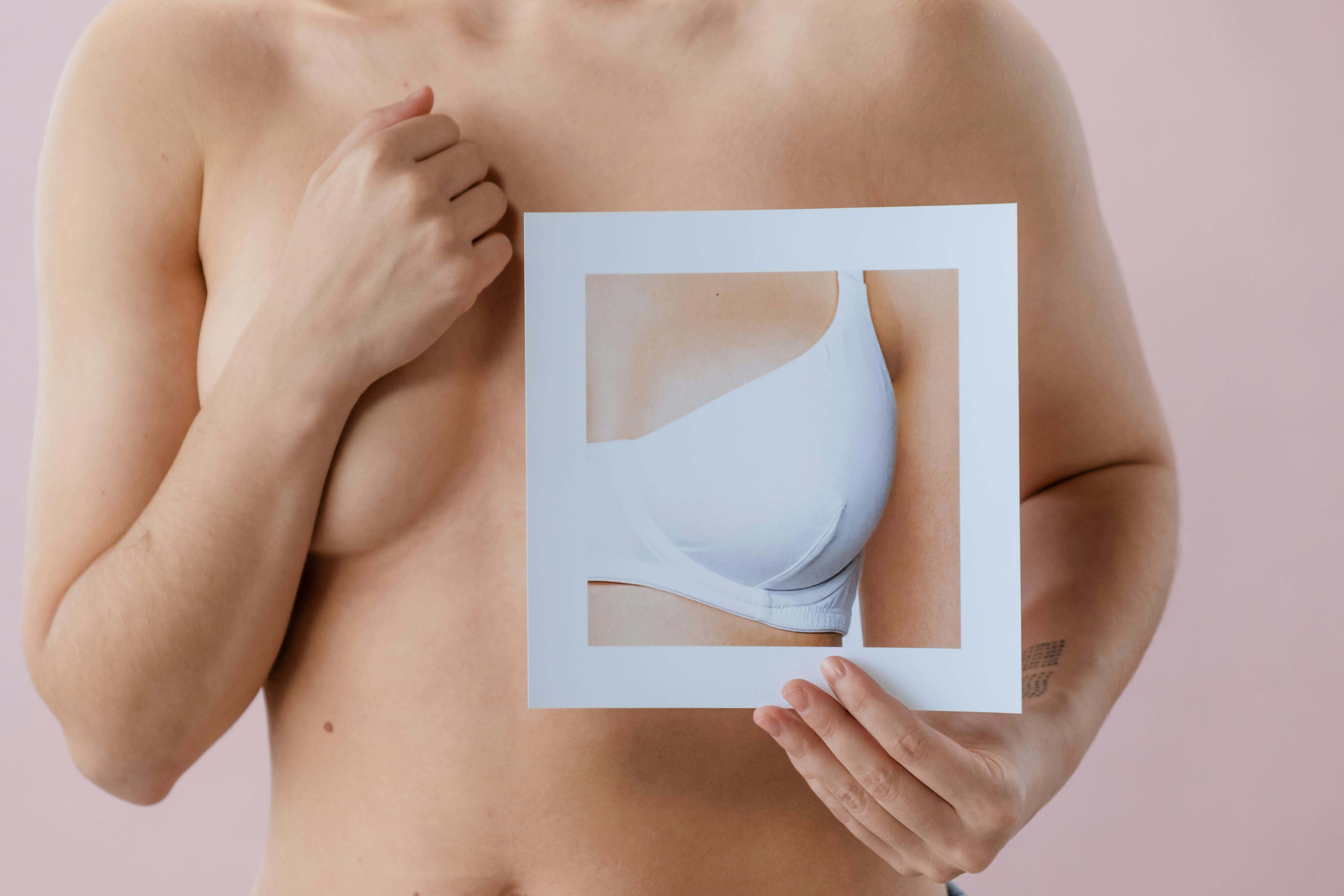 El cáncer de mama es una enfermedad en la cual las células de la mama se multiplican sin control