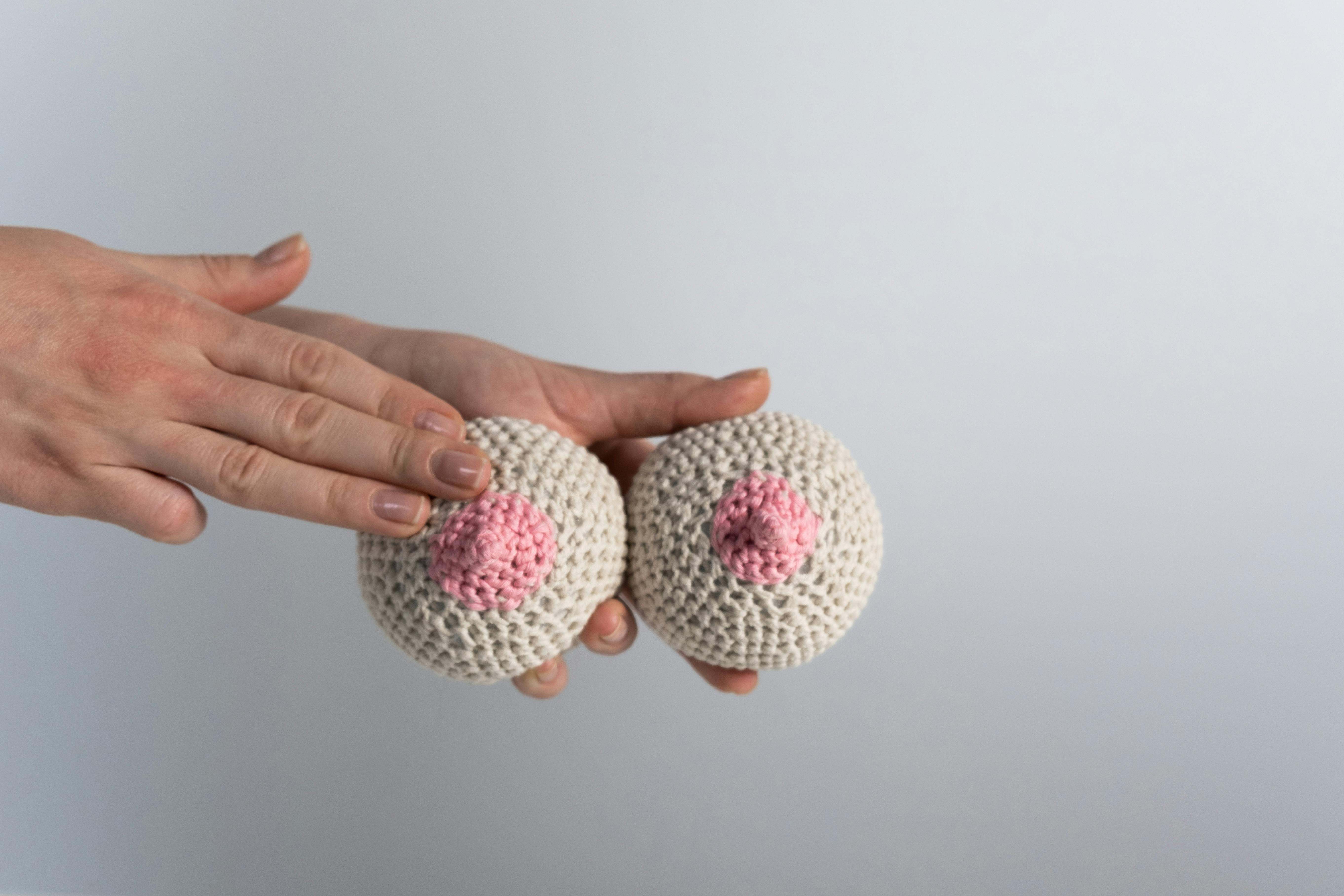 El cáncer de mama es el tumor maligno que se origina en el tejido de la glándula mamaria