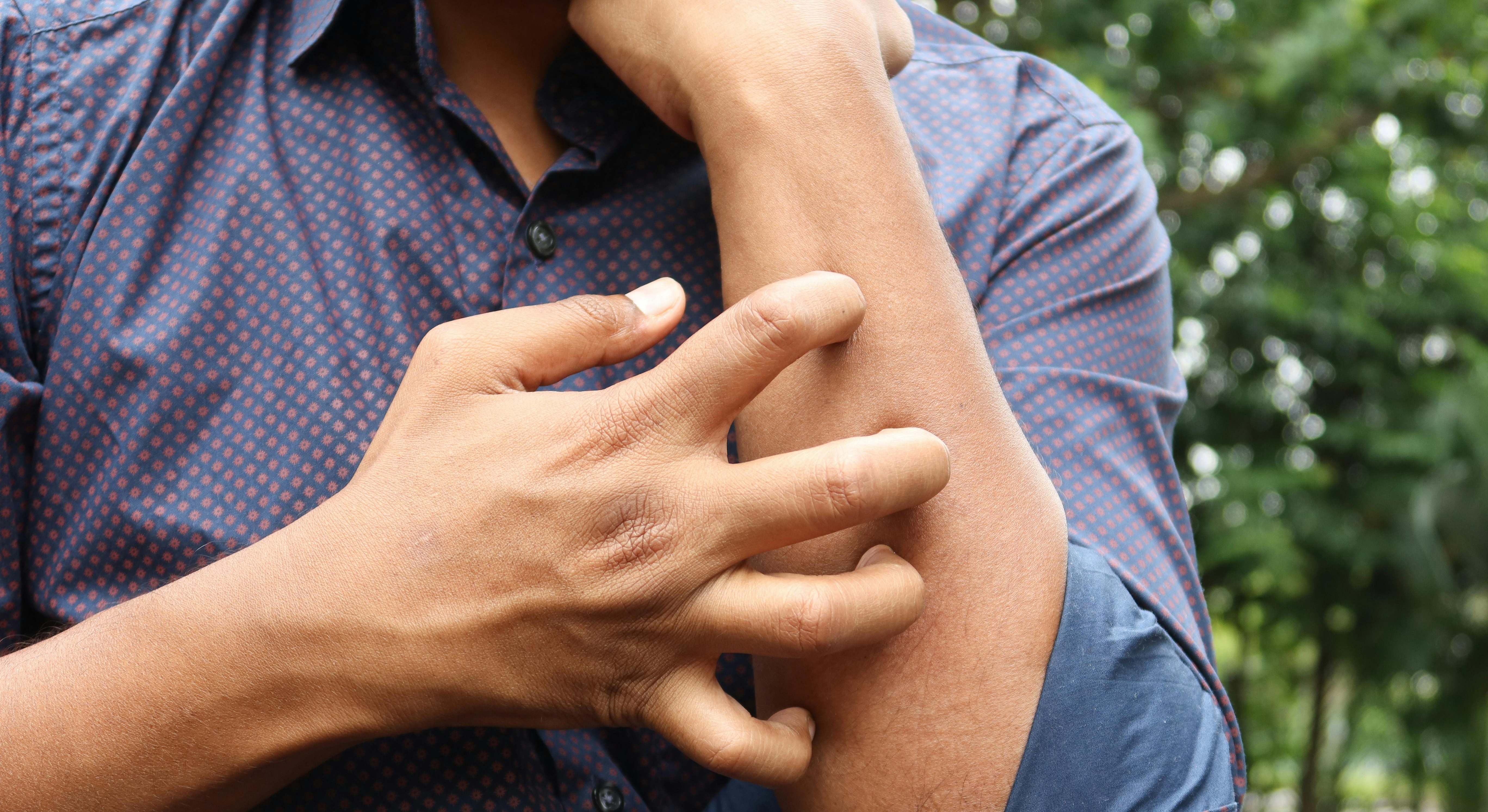 Galenicum crea en la división de dermatología. EE