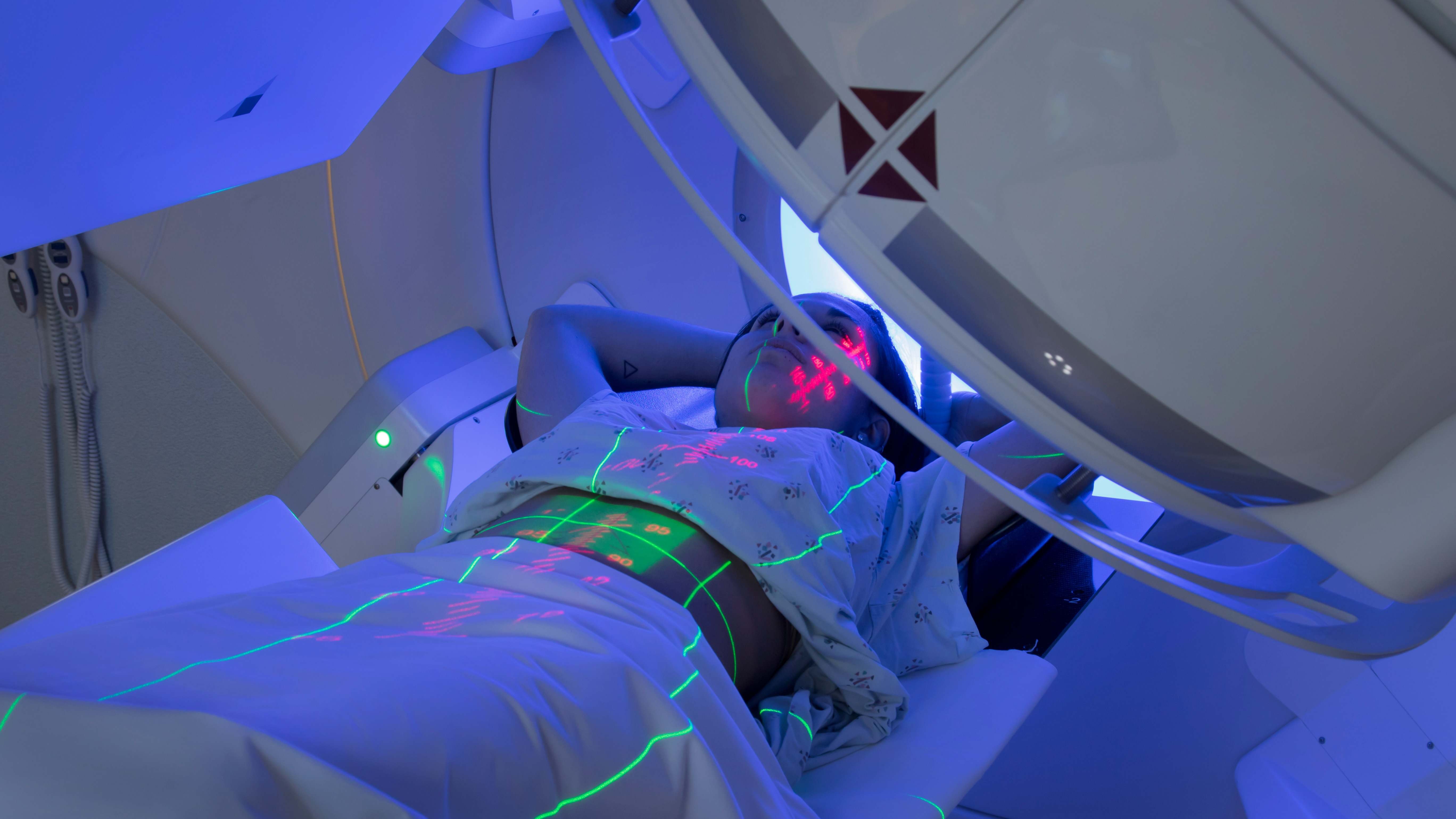 La Oncología Radioterápica es una especialidad médica enfocada al tratamiento personalizado de pacientes con cáncer.
