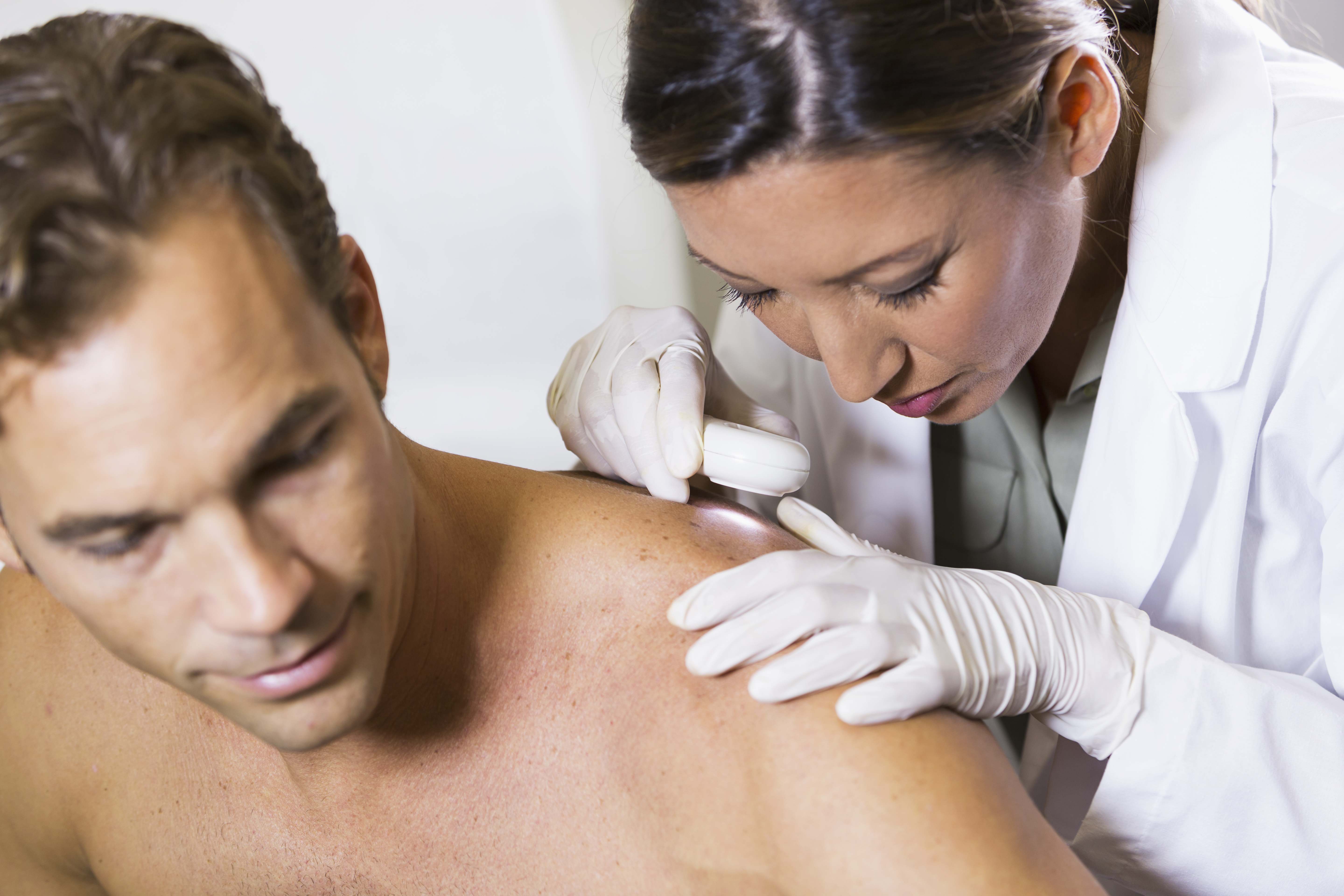 Melanoma.