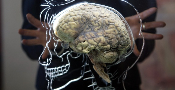 cerebro-colesterol.jpg