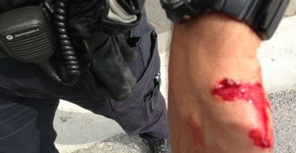 antidisturbio-herido-ep.jpg