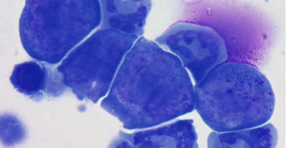 molecula-cancer-efe.jpg