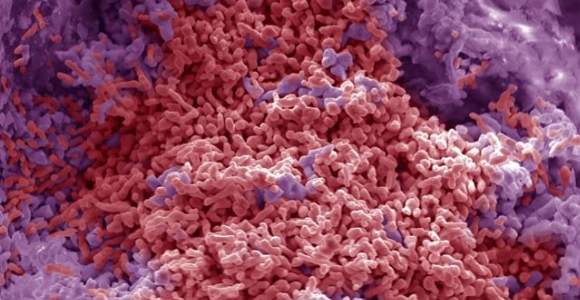 organismo-extermofilo-csic.jpg