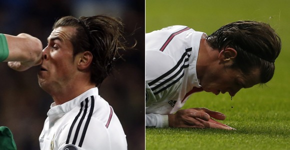 Montaje-Bale-codazo-sangre-2014-reuters.jpg