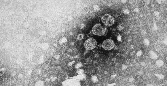 hepatitis-c-microscopio.jpg