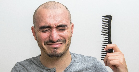 hombre-calvo-thinkstock.jpg