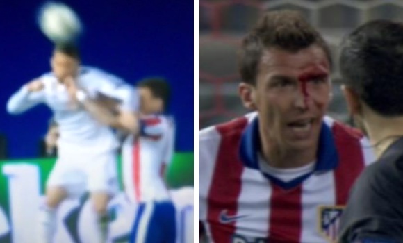 Mandzukic