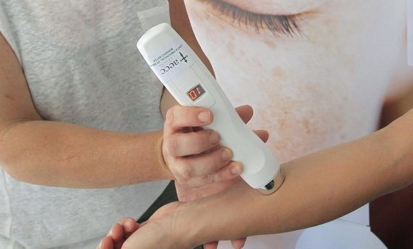 prueba-melanoma-efe.jpg