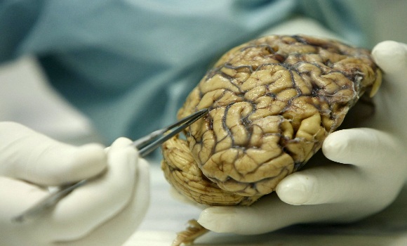 cerebro-efe-580x350.jpg