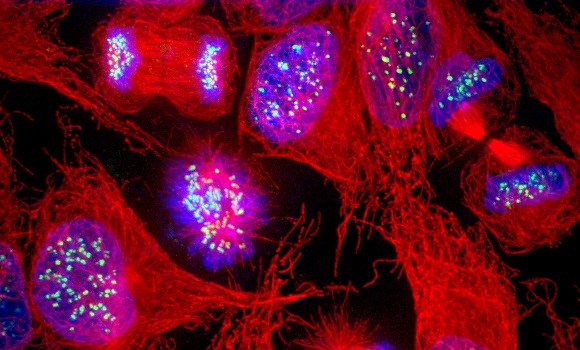 cancer-celulas-getty.jpg
