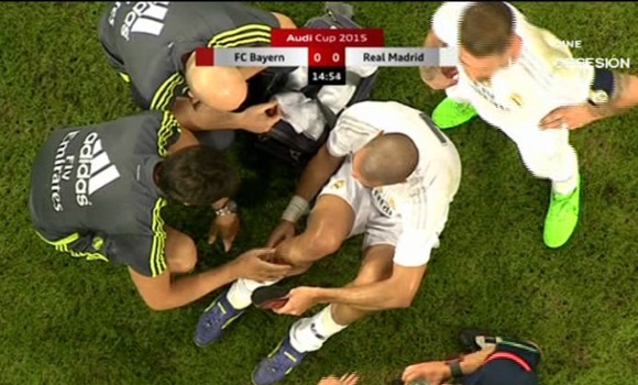 Pepe