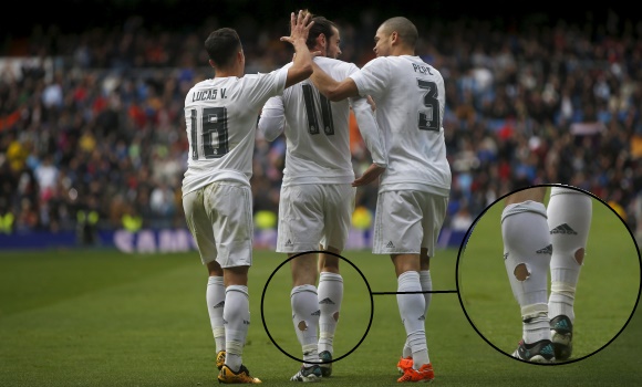 Medias-Bale-2016-agujeros-reuters.jpg