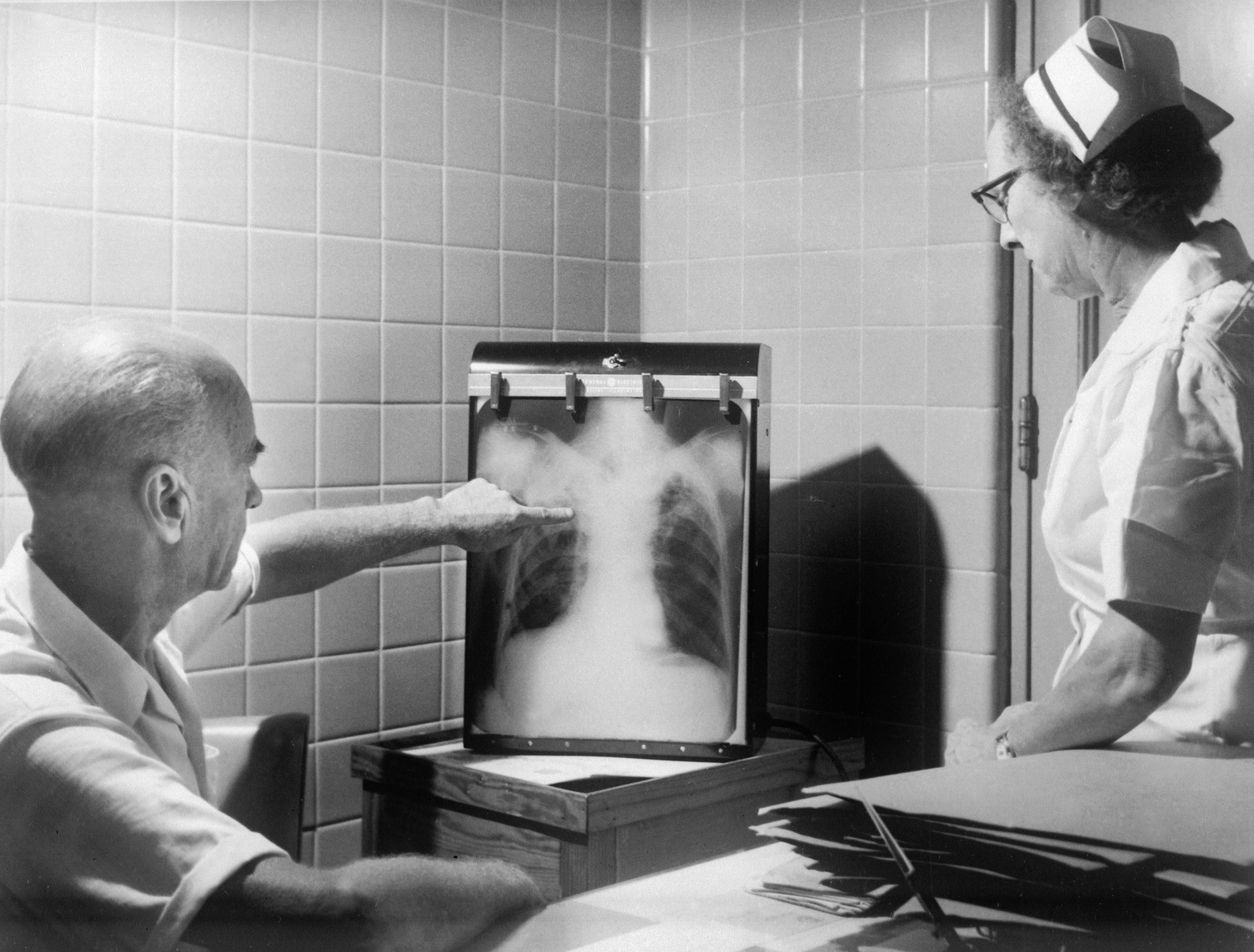 El desarrollo pulmonar se inicia durante la cuarta semana