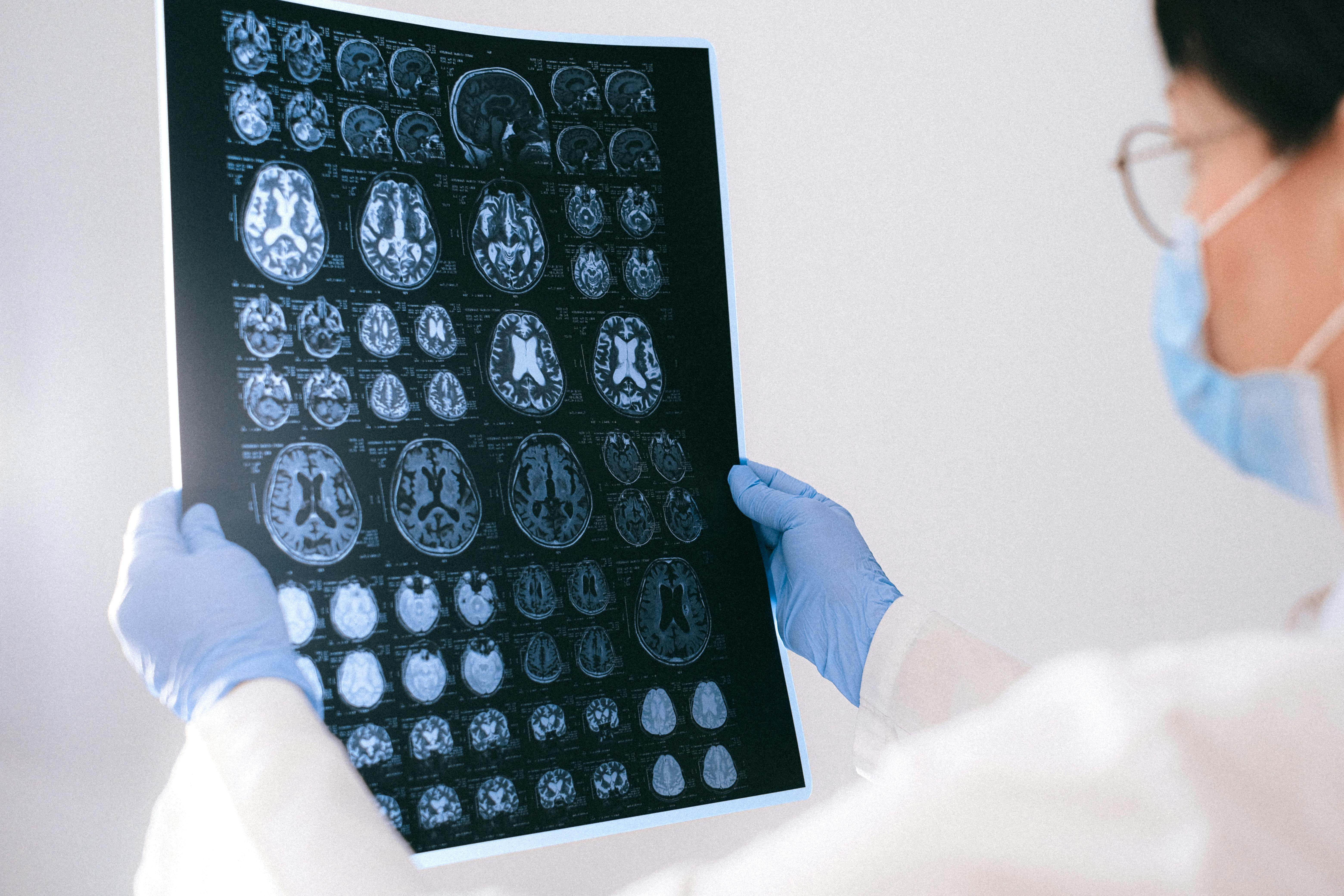 La neurona es la unidad estructural, trófica y funcional del tejido nervioso