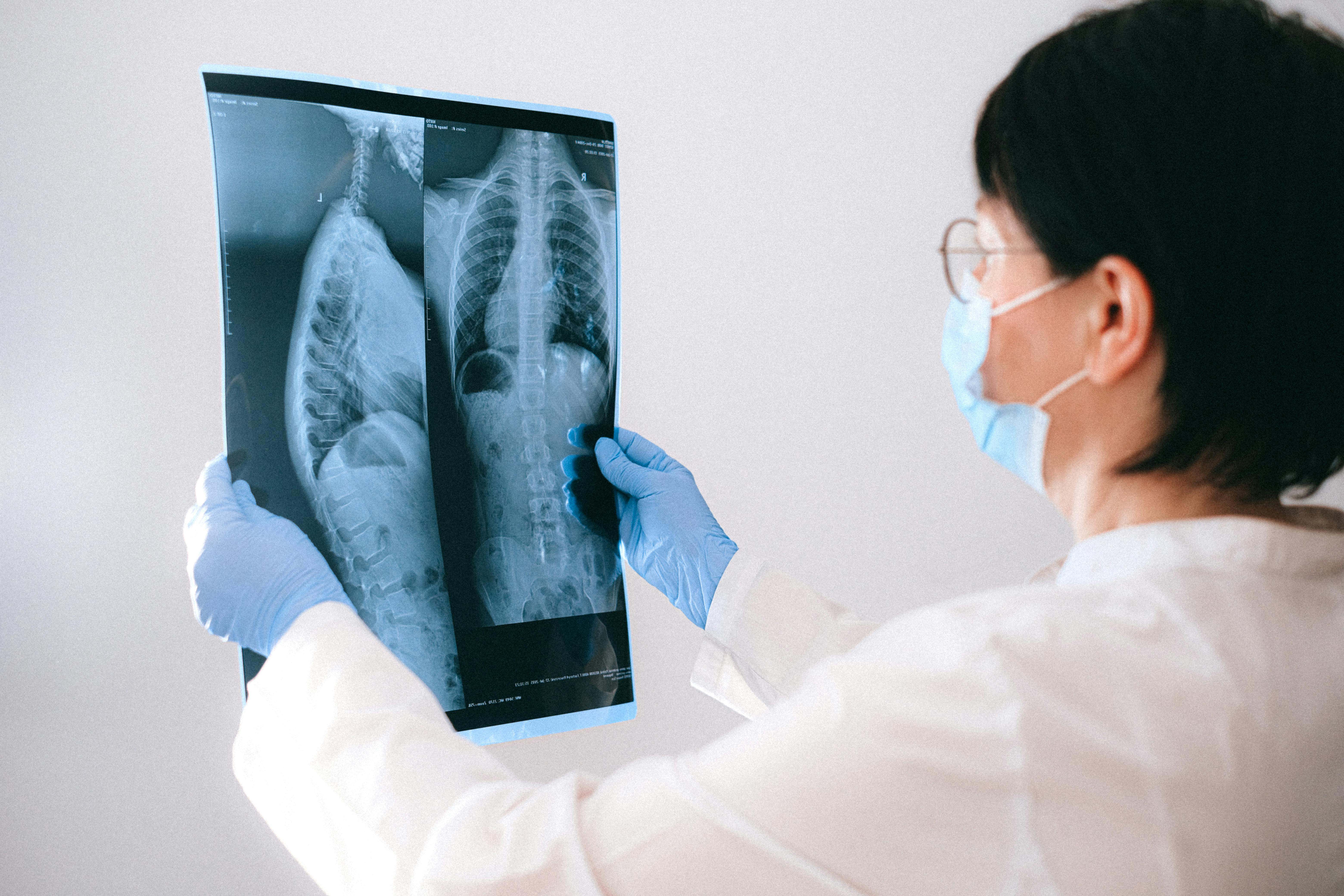 Los microplásticos que entran al cuerpo humano pueden causar una variedad de impactos a la salud