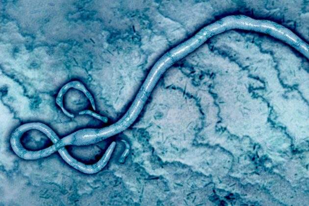 ebola-dreamstime.jpg
