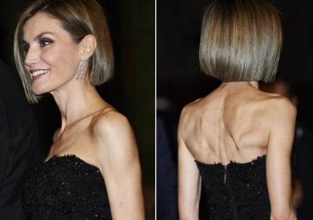 anorexletiz.jpg