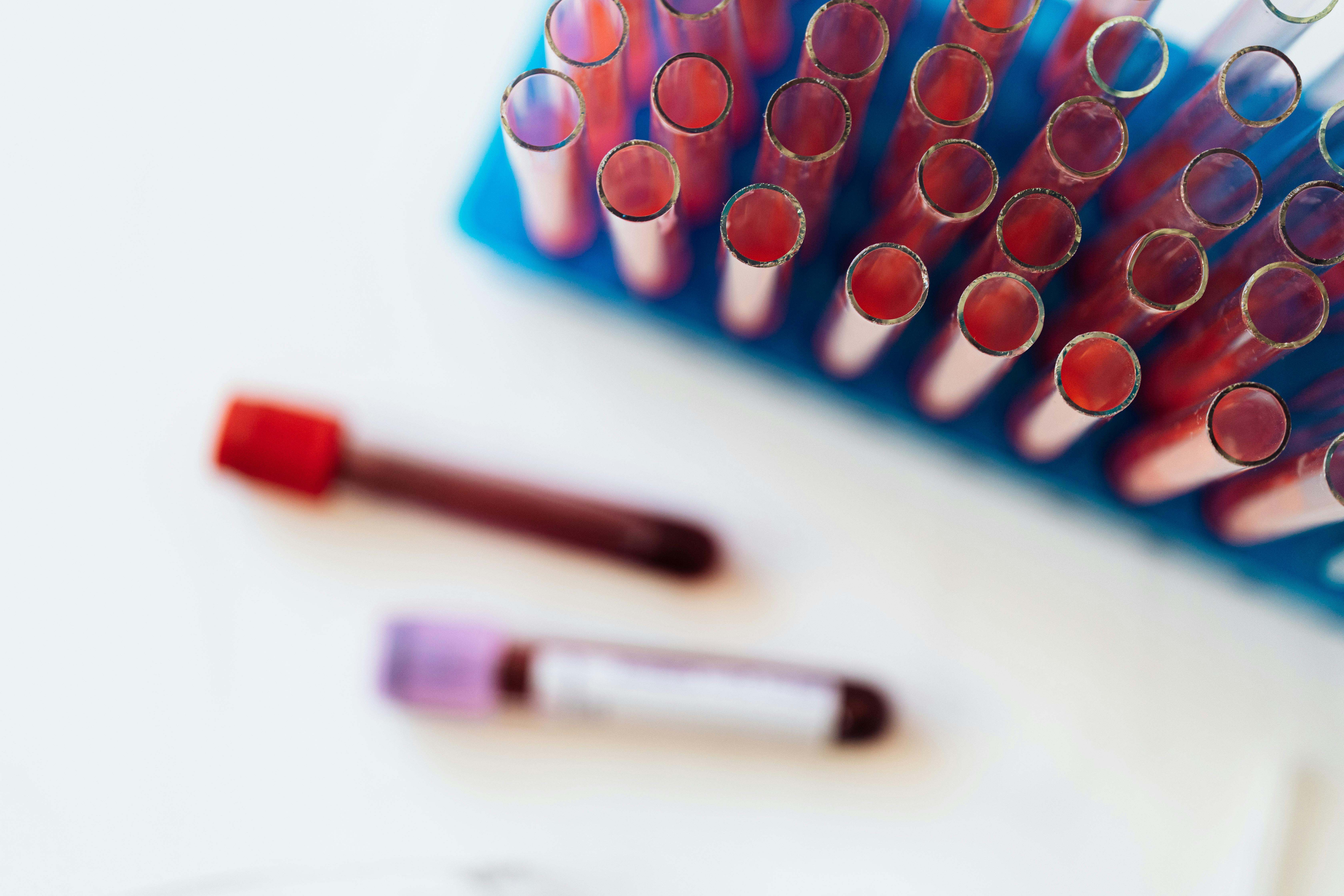 Son proteínas presentes en el plasma sanguíneo