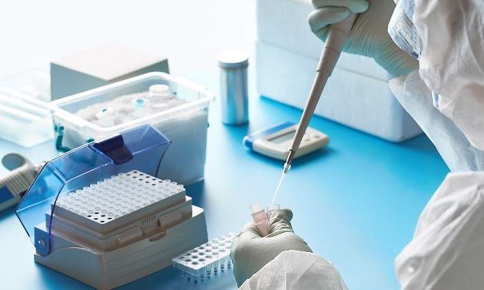 test-antigenos-1.jpg