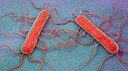 Magrudis, la cárnica de la listeria, tiene una sociedad paralela sin facturación ni alta en el registro sanitario