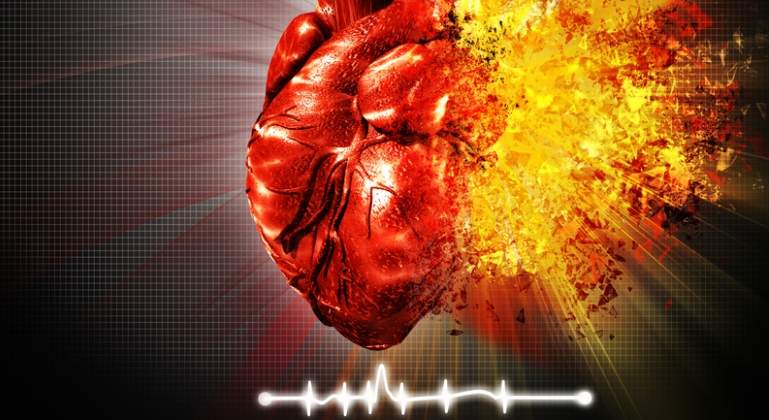 infarto-corazon-dreams.jpg