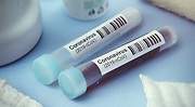 Las empresas que cierren por el coronavirus no tendrán que pagar cotizaciones ni indemnizaciones