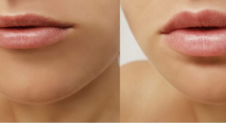 portada-labios.jpg