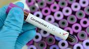 El coronavirus mantiene a la industria del deporte bajo la amenaza de pérdidas multimillonarias