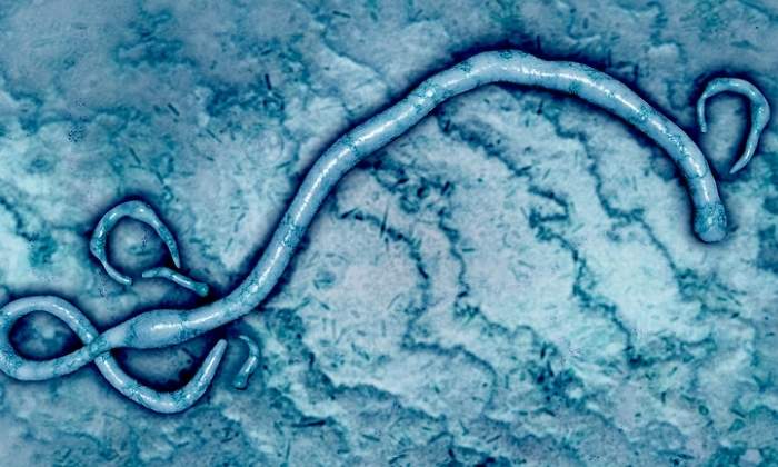 ebola-virus-dreams.jpg