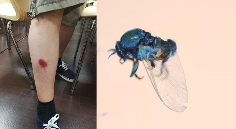 mosca-negra-picadura-insecto-ep.jpg