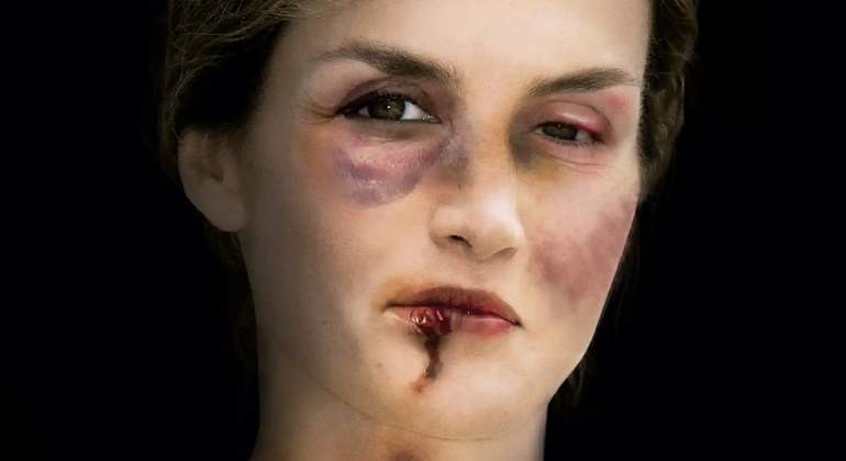 letizia-exposicion-maltrato-770.jpg